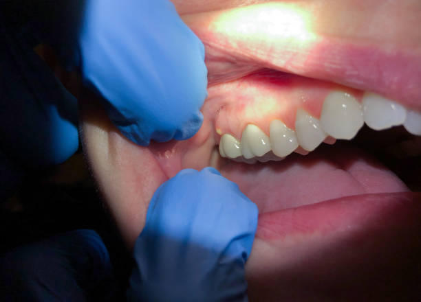Best Broken or Cracked Tooth Emergency Dentist in Terrell Hills, TX